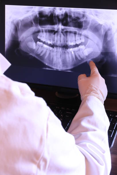 Best Broken or Cracked Tooth Emergency Dentist in El Cerrito, CA