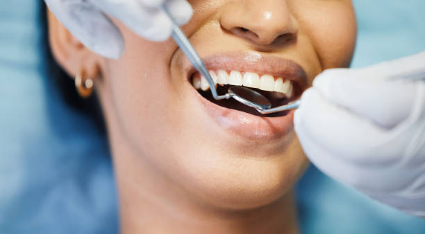 Best Weekend Emergency Dentist in El Cerrito, CA