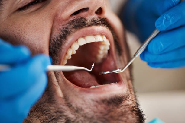 Best Emergency Dental Care for Abscessed Tooth in El Cerrito, CA