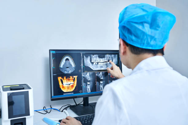 Best Emergency Dentist for Knocked-Out Tooth in El Cerrito, CA